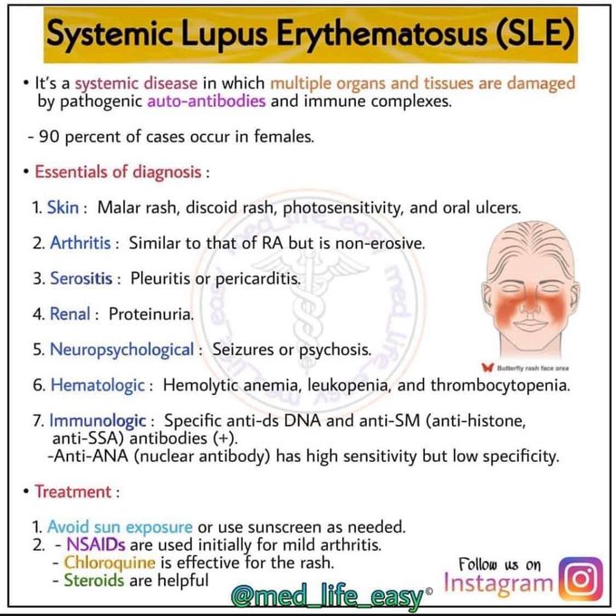 Systemic lupus Erythematosis