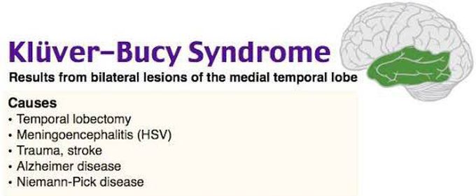 These are the causes of Kluver bucy syndrome