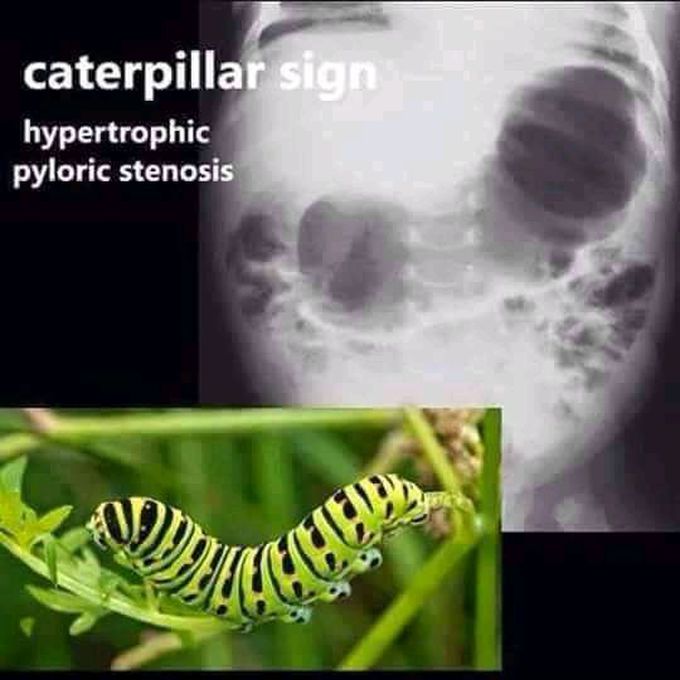 X ray easy