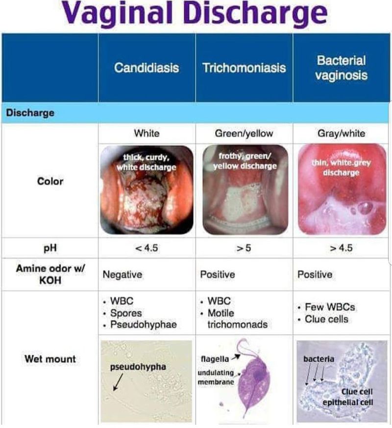 Types of Vaginal Discharge