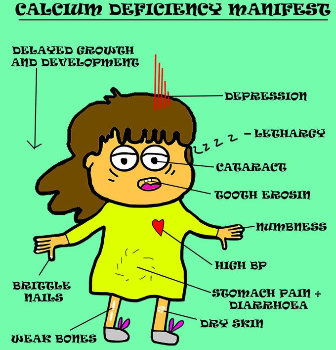 Calcium deficiency picmonic