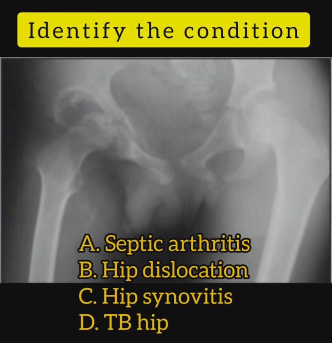 Identify the Condition