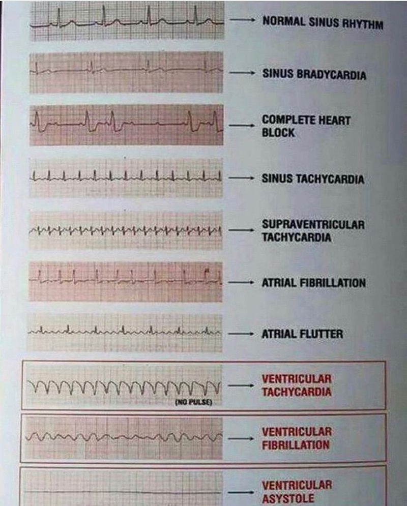 Cardiovascular - MEDizzy