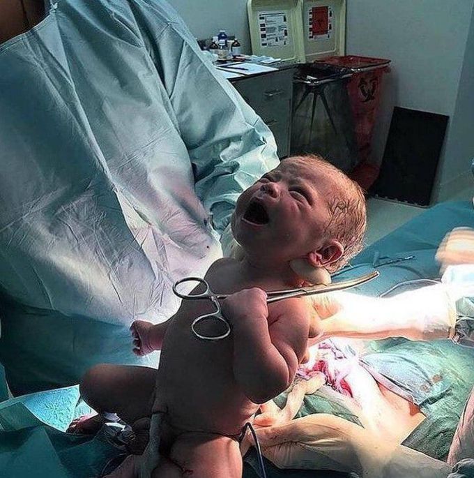 A newborn holding a hemostat