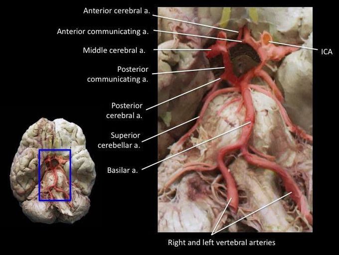 Circle of Willis