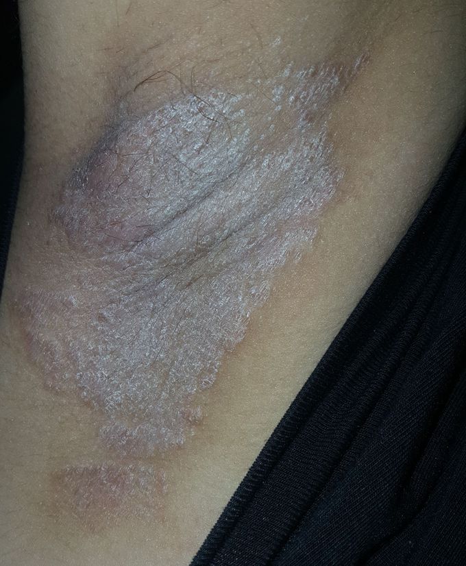 Diagnosis and Treatment..?