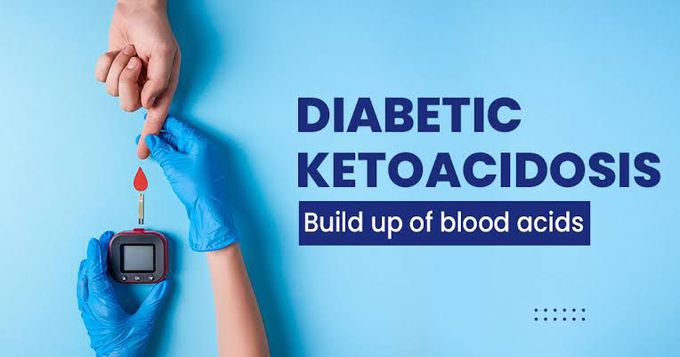 Risk of diabetic ketoacidosis