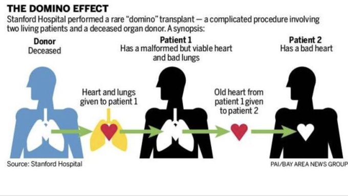 Domino heart transplant