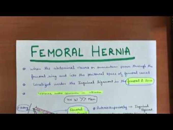 Femoral Hernia: Introduction