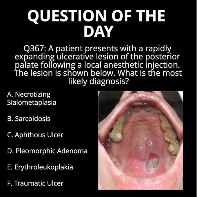 Oral pathology case study