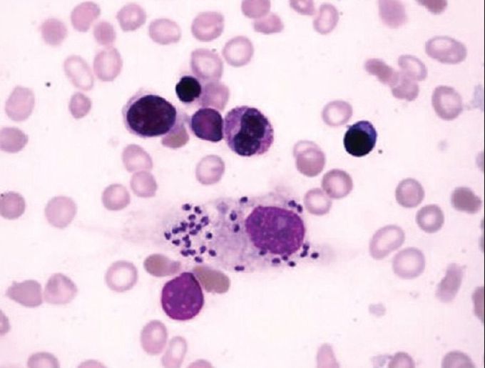 After histological examination what would be your diagnosis?