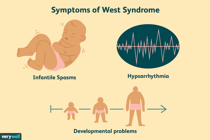 Symptoms of west syndrome
