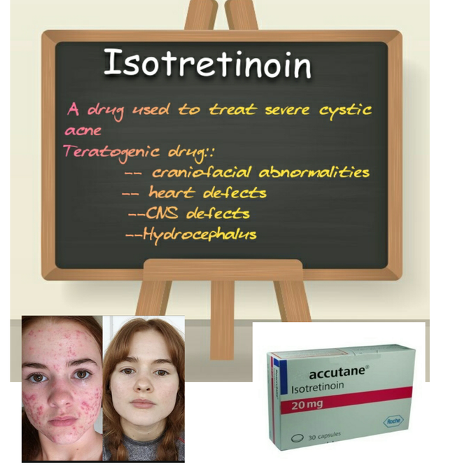 Isotretinoin