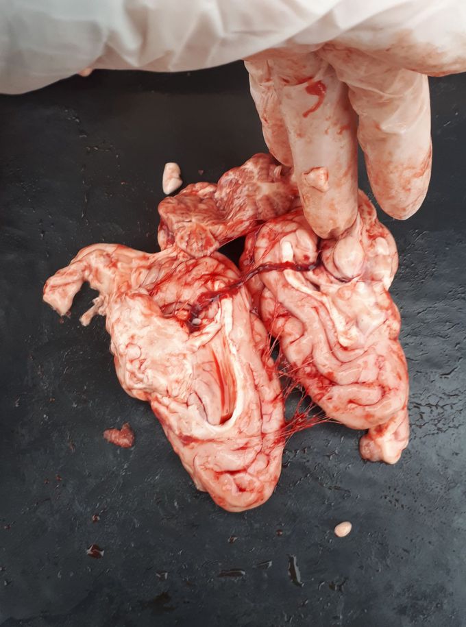 Brain