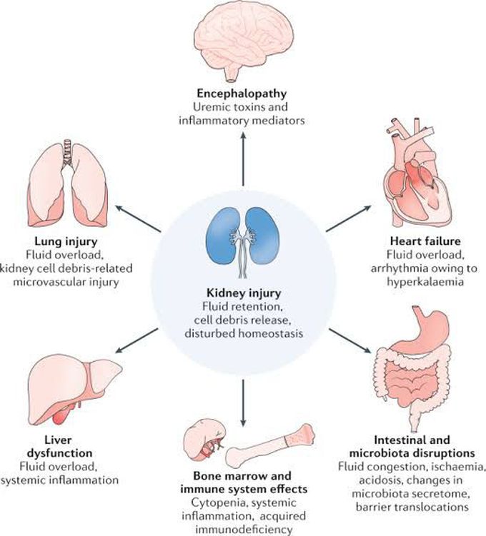 Symptoms of acute kidney injury