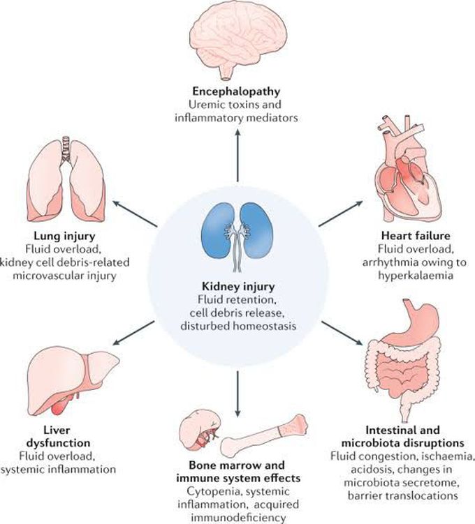 symptoms-of-acute-kidney-injury-medizzy