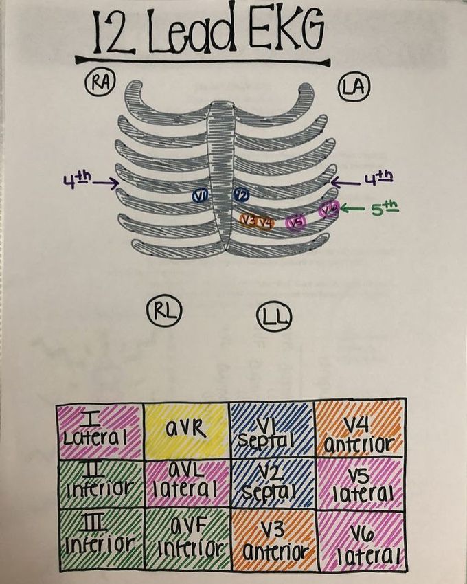 ECG  mneumonic