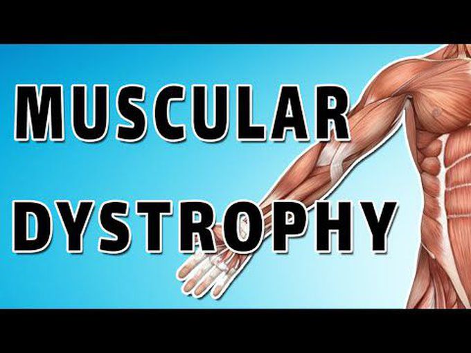 Symptoms, treatment and causes of Duchene muscular dystrophy