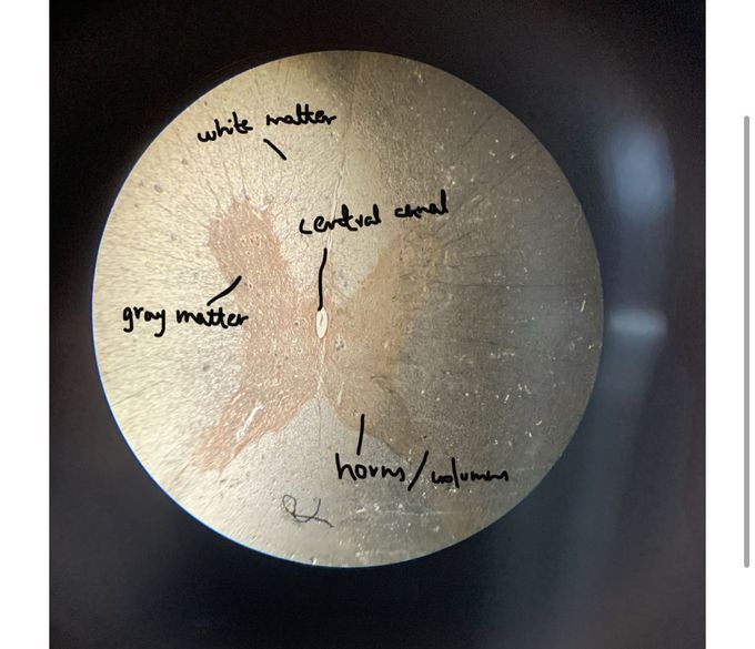 Spinal Cord