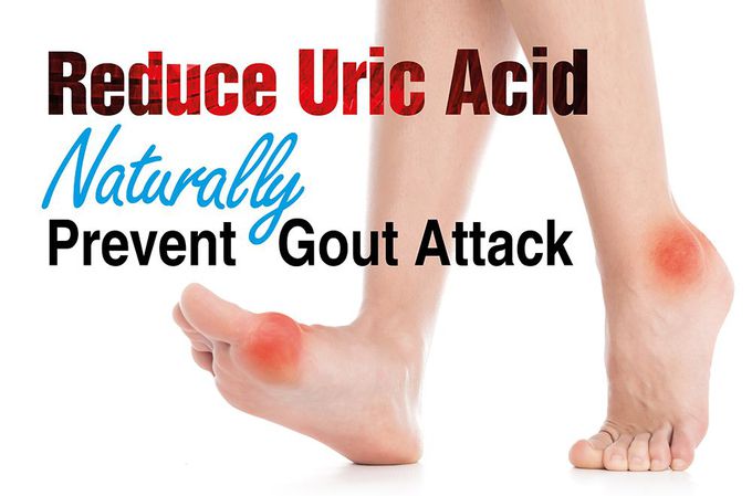 Treatment for uric acid