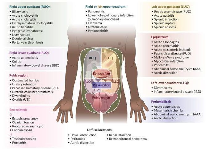 abdominal-pain-dd-medizzy