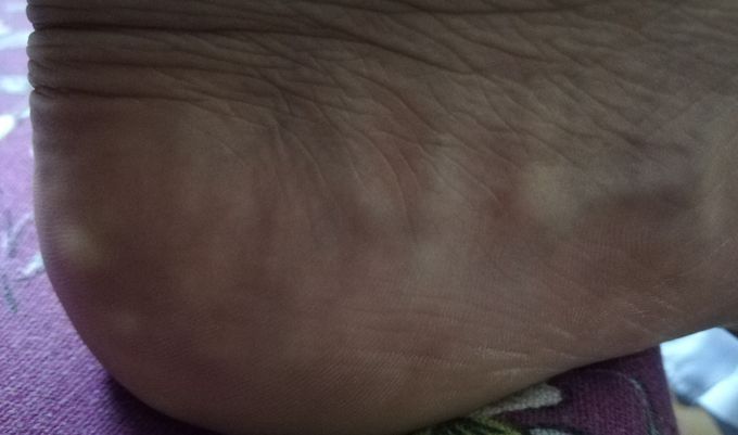 Imoressions on foot