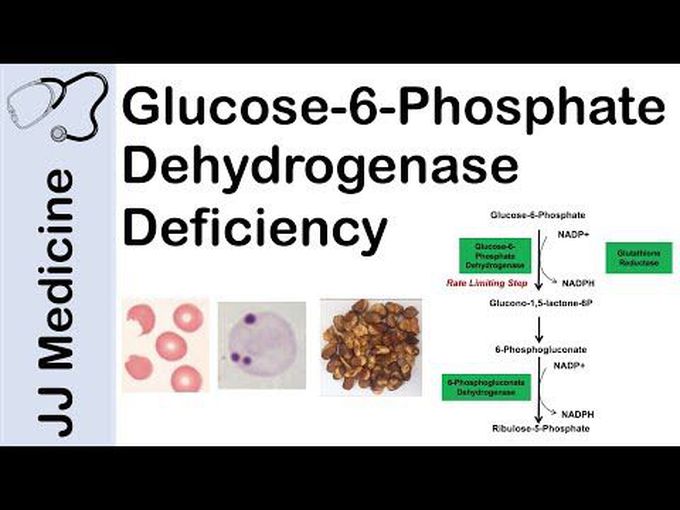 Deficiency of Glucose-6-Phosphate Dehydrogenase