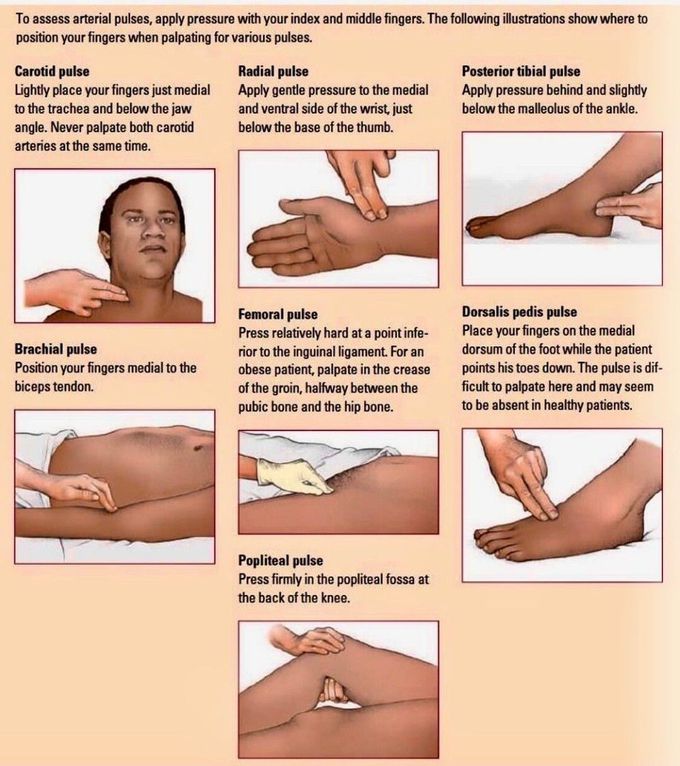 Assessing Arterial Pulses