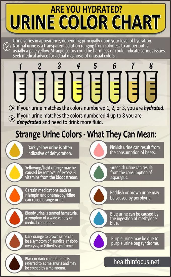 Urine colour chart that shows how dehydrated your child is