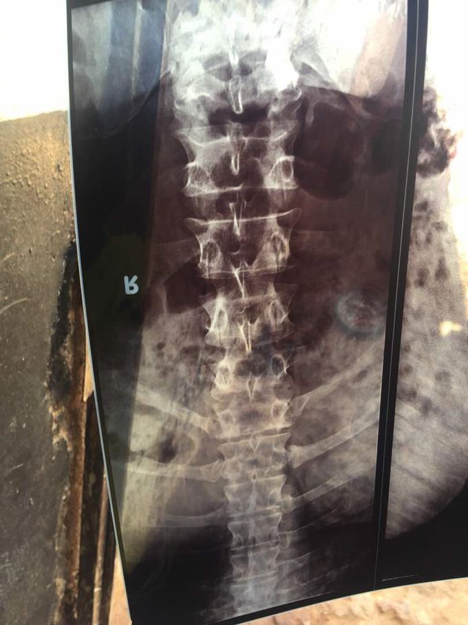 Please what is diagnosis and treatment