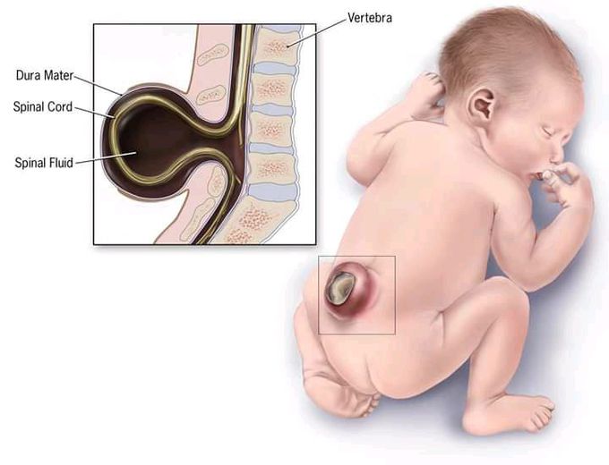 What is ur diagnosis?