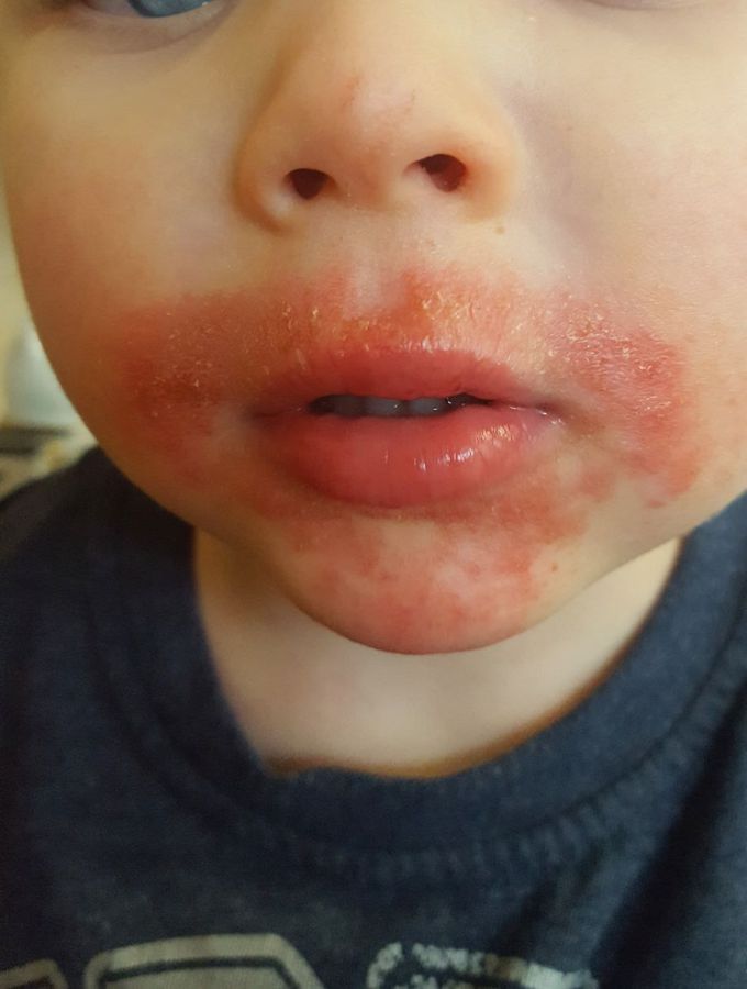 Diagnosis?
