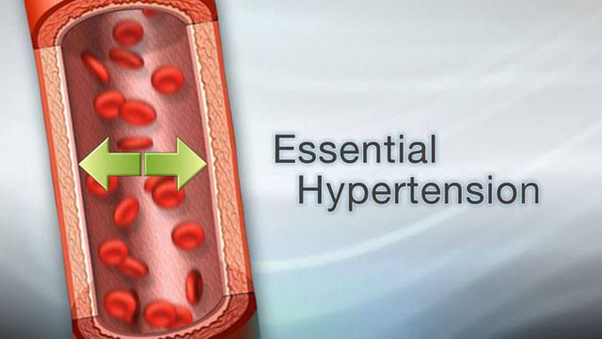 Essential hypertension