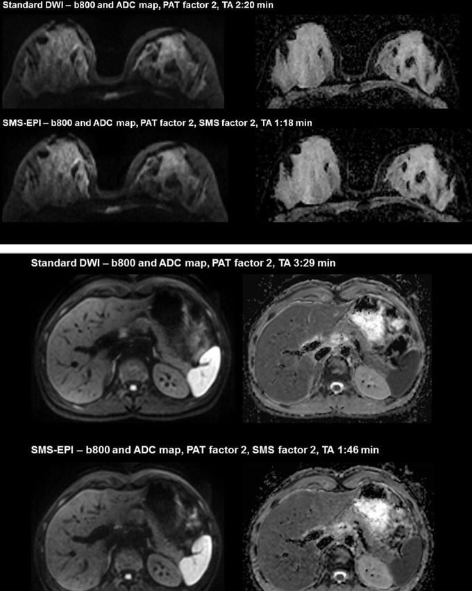 diffusion-weighted-imaging-medizzy