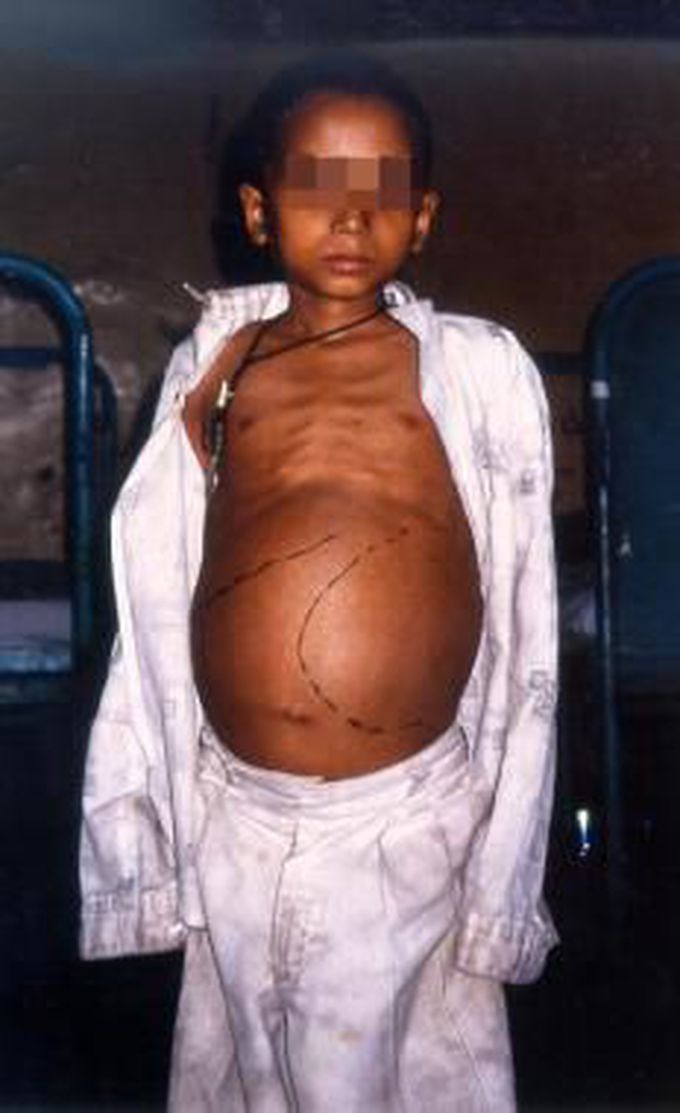 What is your diagnosis