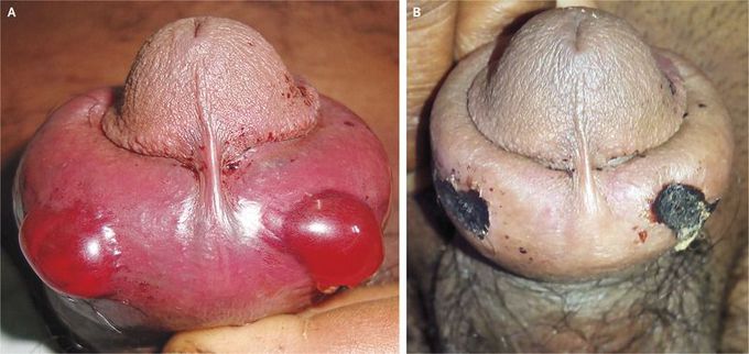 A Viper Bite