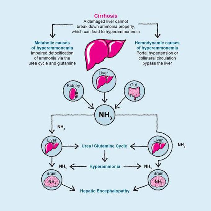 Hepatic Encephalopathy