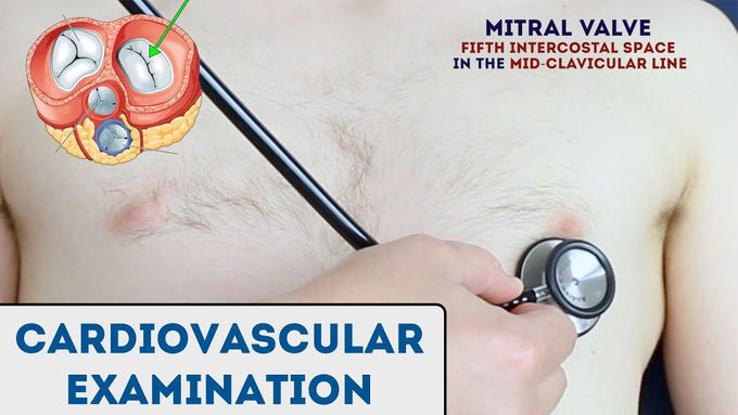 Cardiovascular Examination - OSCE Guide