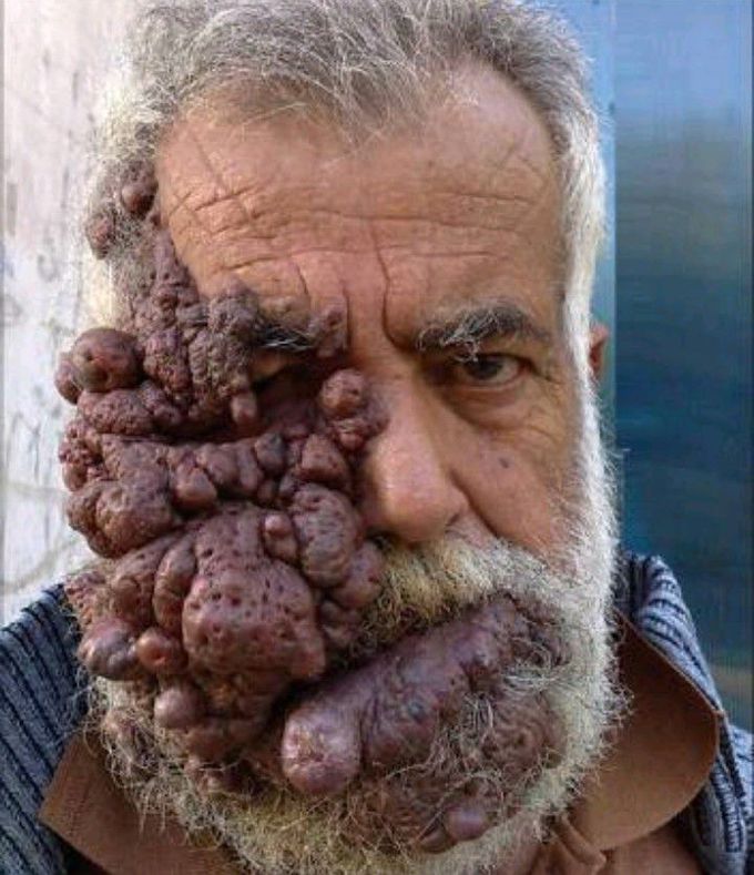 Diagnosis