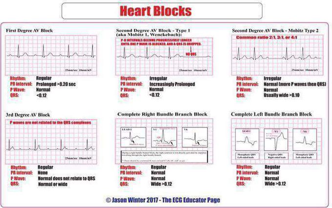 ecg-medizzy
