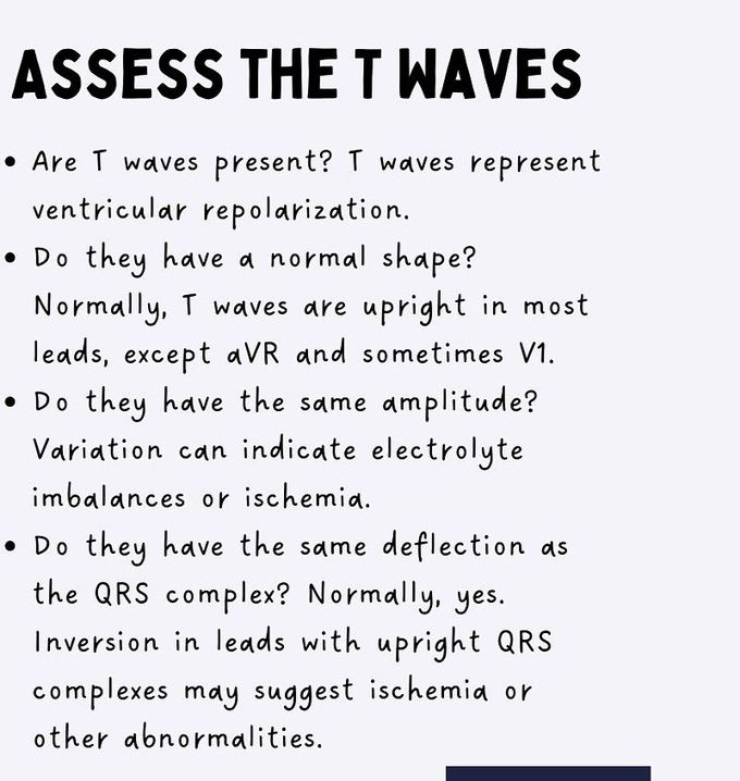 How to Read ECG- VI