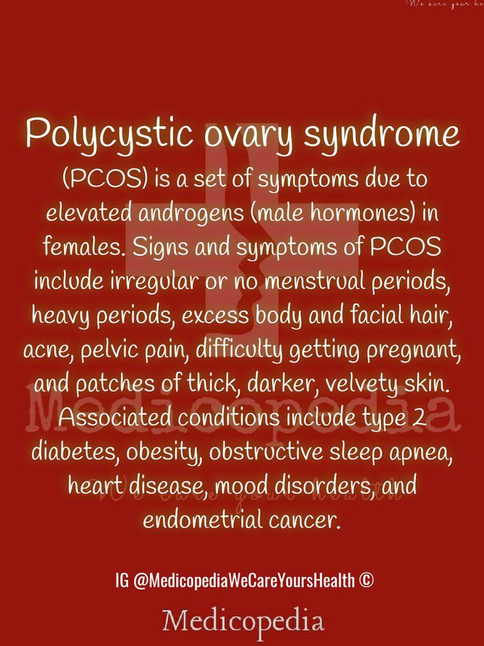 Polycystic ovary syndrome