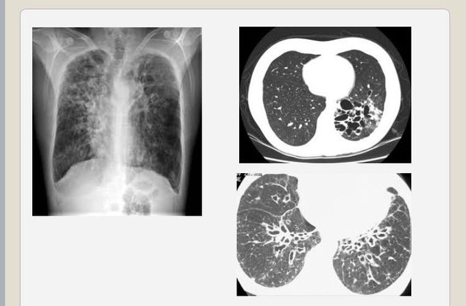 Diagnosis??