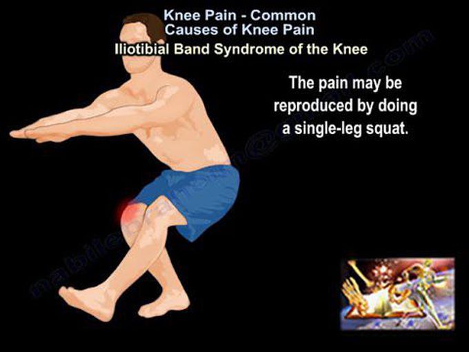 Knee Pain - Everything You Need To Know - Dr. Nabil Ebraheim