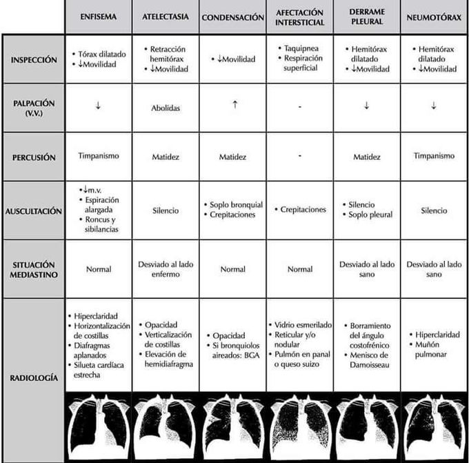 Pulmonary syndromes