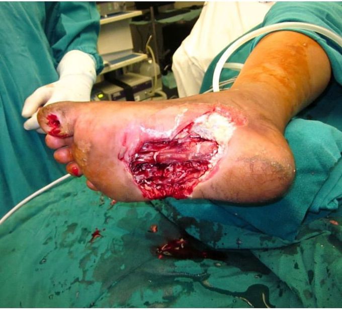 What is your diagnosis??