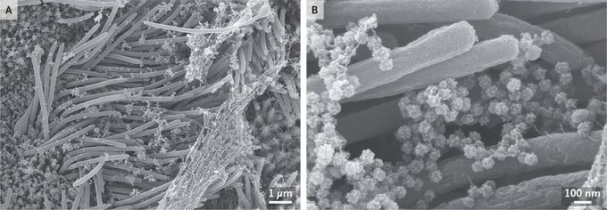 SARS-CoV-2 Infection of Airway Cells