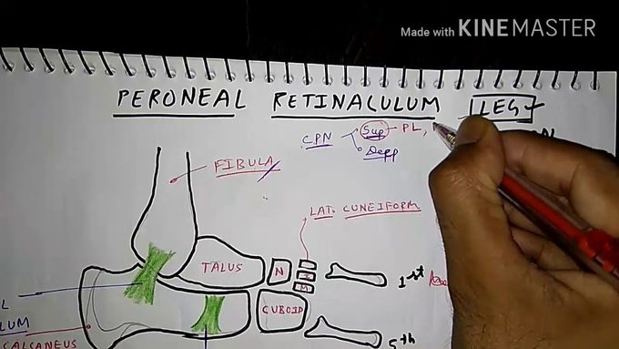 Peroneal retinaculum ( LEG ) 👢👢
