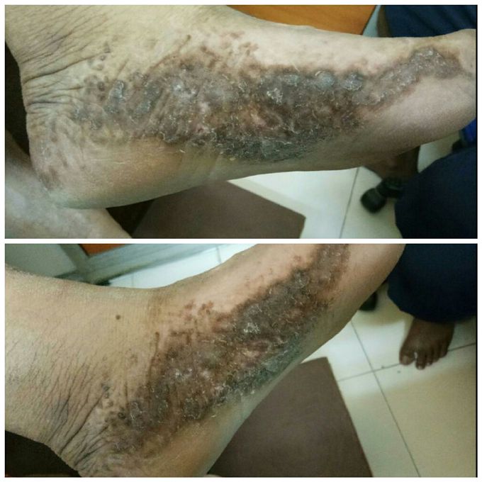 Diagnosis??