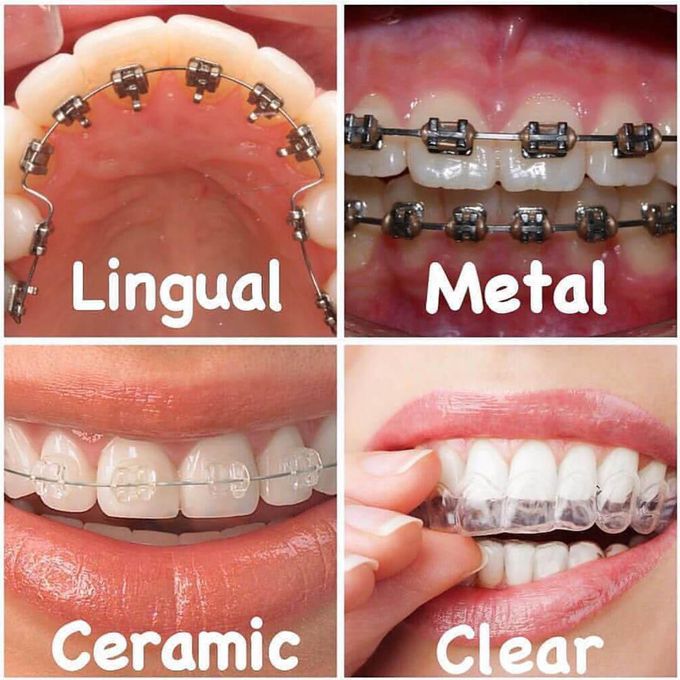 50 Shades of Orthodontics